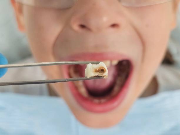Best Weekend Emergency Dental Services in Hannibal, MO